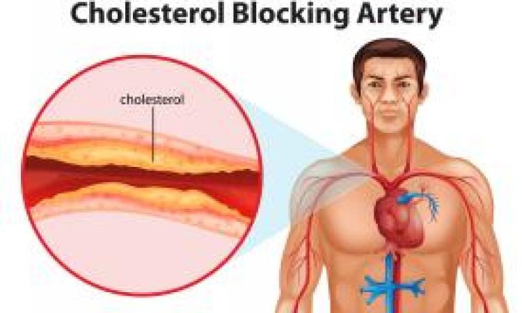 Ways to Lower Cholesterol - Why a Diet Low in Fat and Cholesterol Can Help You