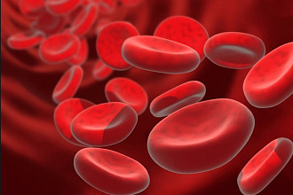 Anemia