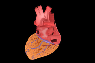 Angina
